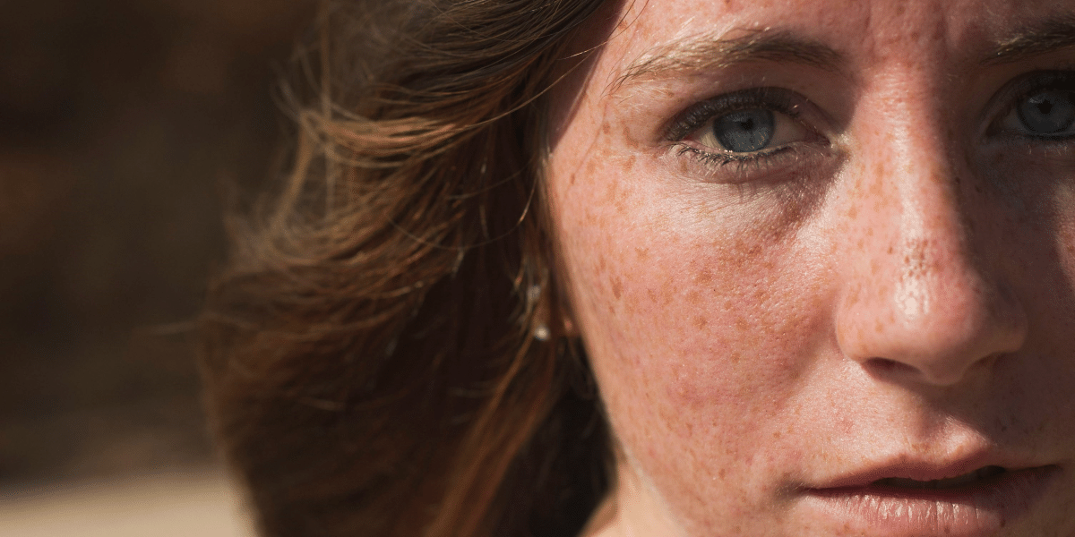 Permanent Freckles- Embracing Natural Beauty Trends in 2024